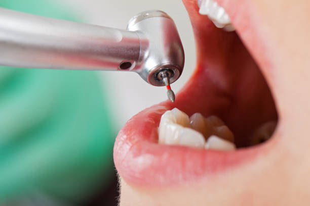 Best Emergency Dental Care for Trauma or Injury in Silver Lake, OH
